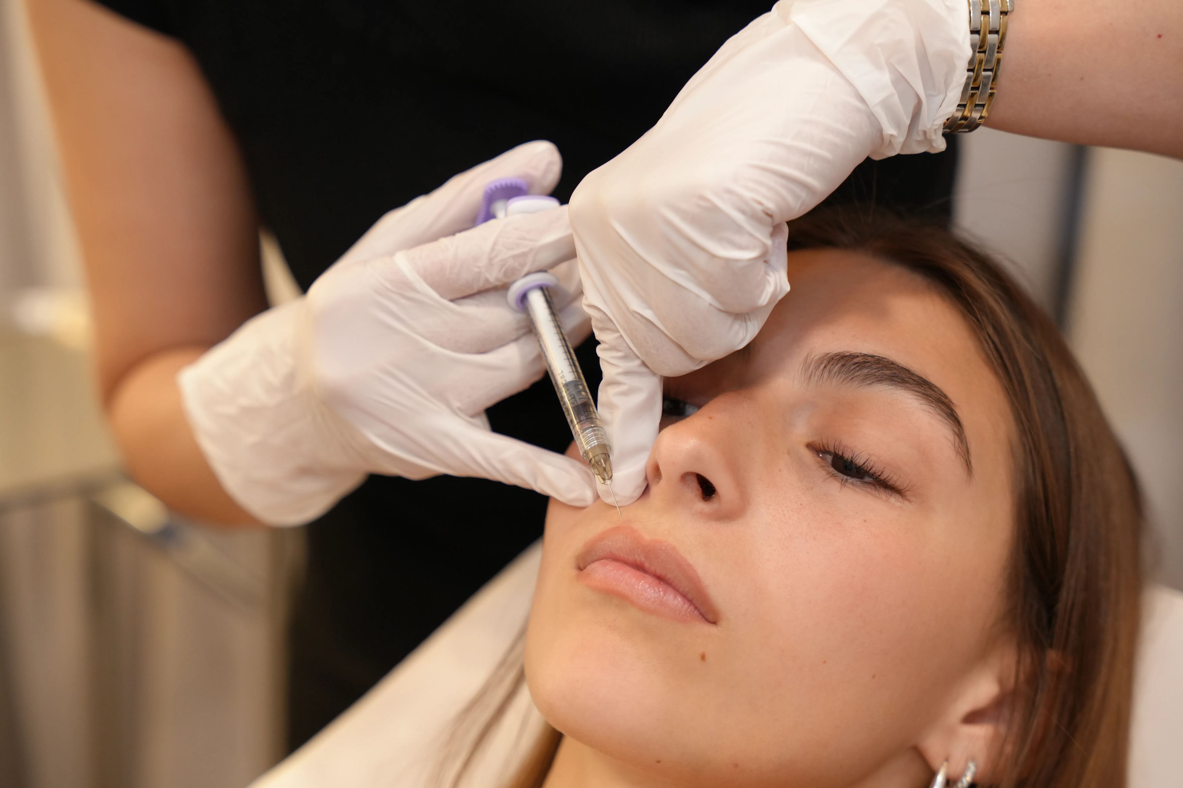 What to expect from Hyaluronic Acid Lip Fillers for Soft, Balanced Lips treatment at Toronto medical spa - treatment journey